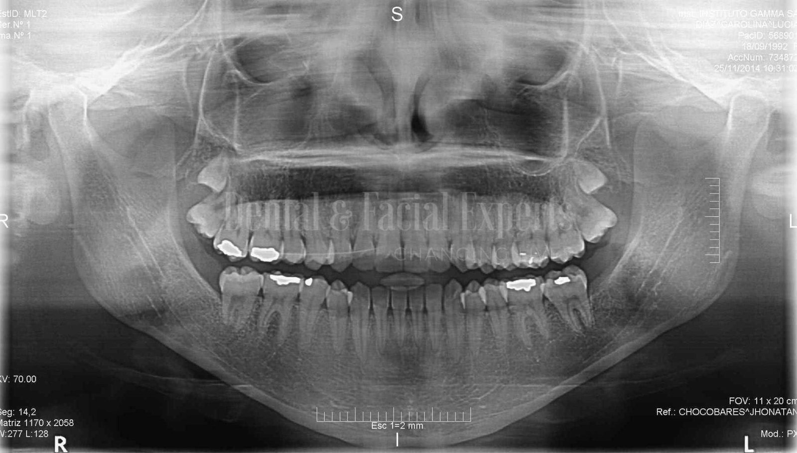 Carolina-Dا_az-P-081214-1-1