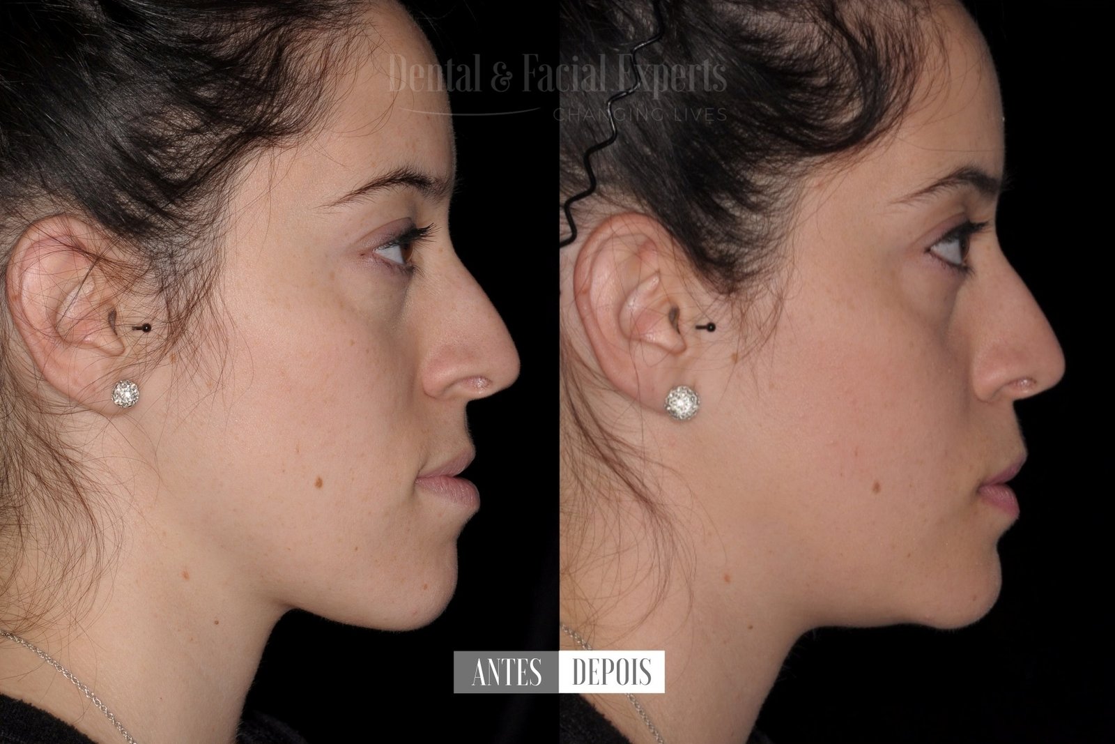 Carolina-antes-e-depois-casos2