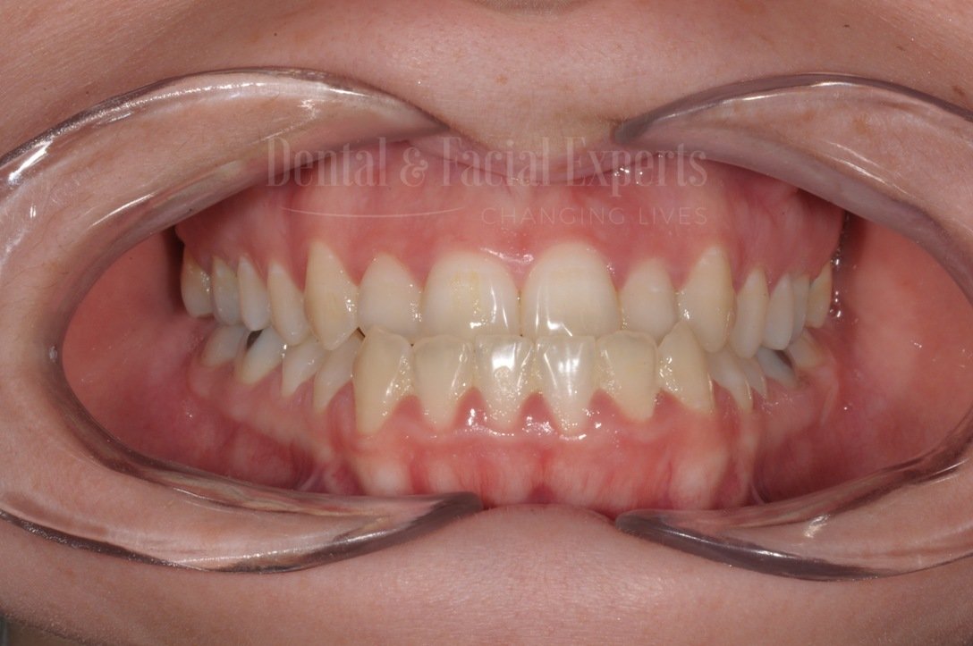 ????????????????????????????????????