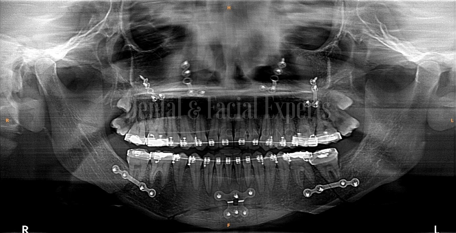Diaz-Carolina.Panoramica