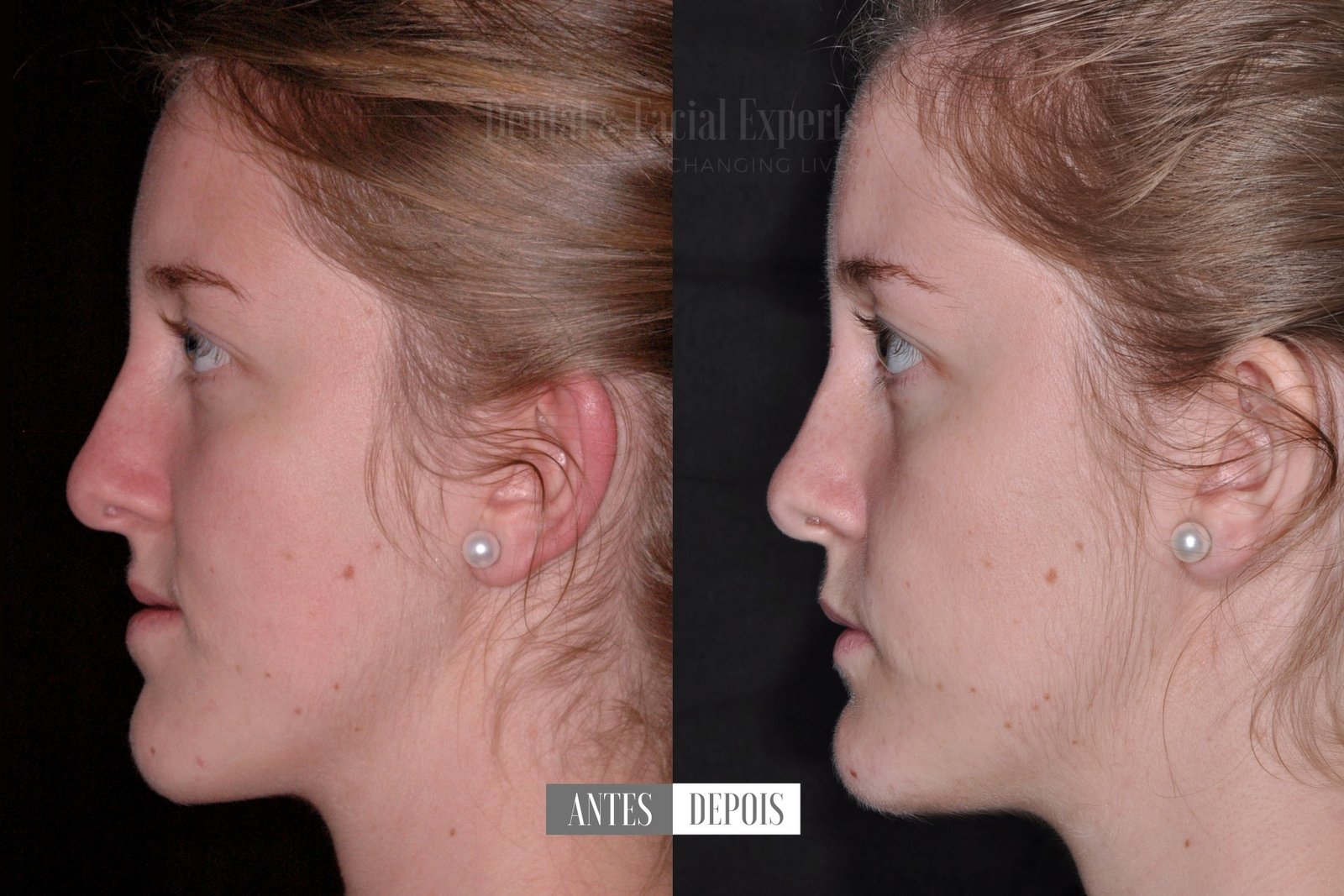 Georgina-antes-e-depois-casos