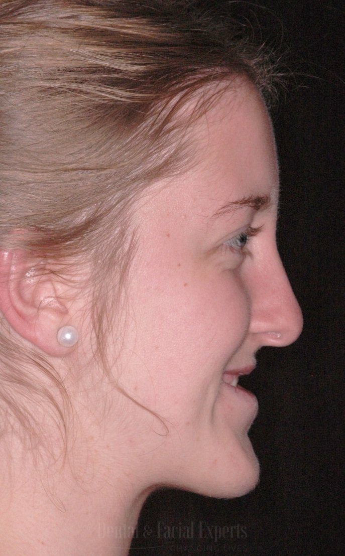 Georgina-lado-CÇüpia-1