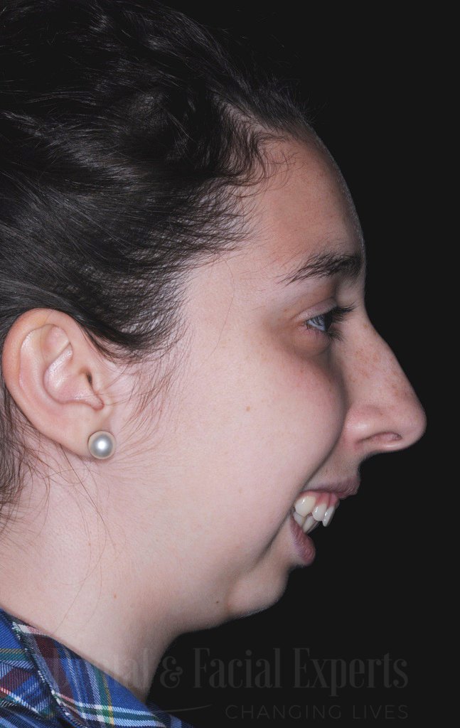 bianca-lado-antes-e-depois-CÇüpia-1