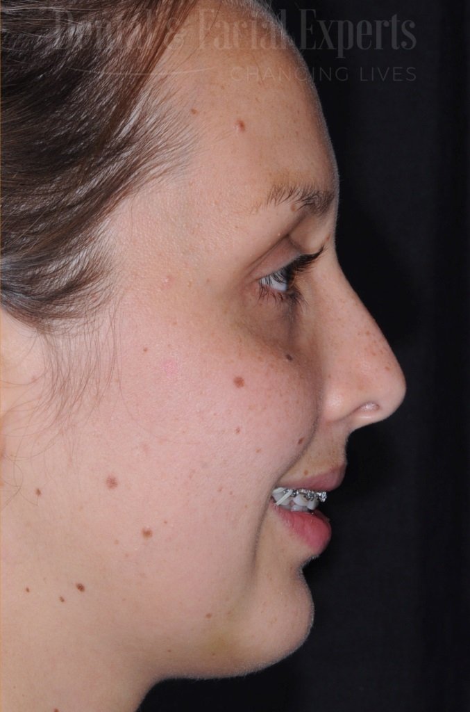 natalia-antes-e-depois-1