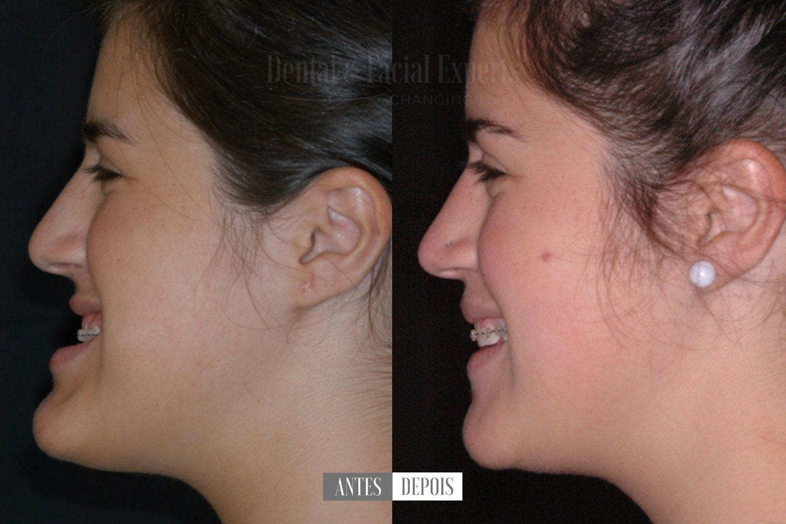 rocio-antes-e-depois-casos