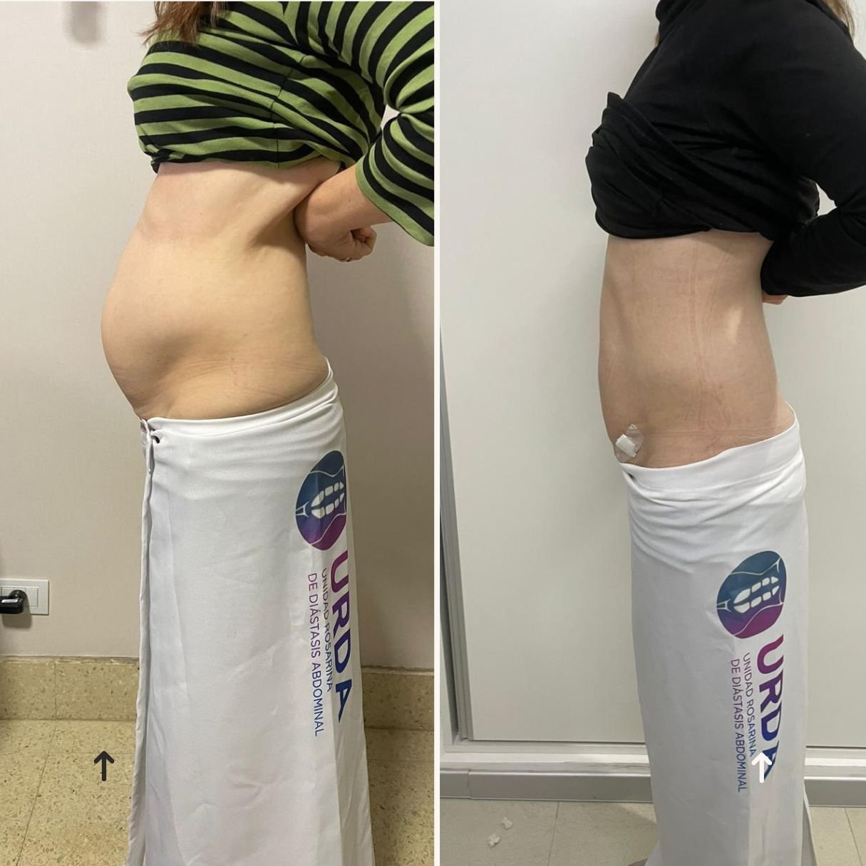 antes y despues dia...1