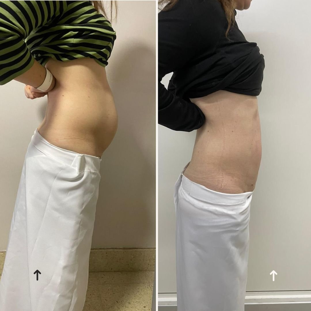 antes y despues dia...2