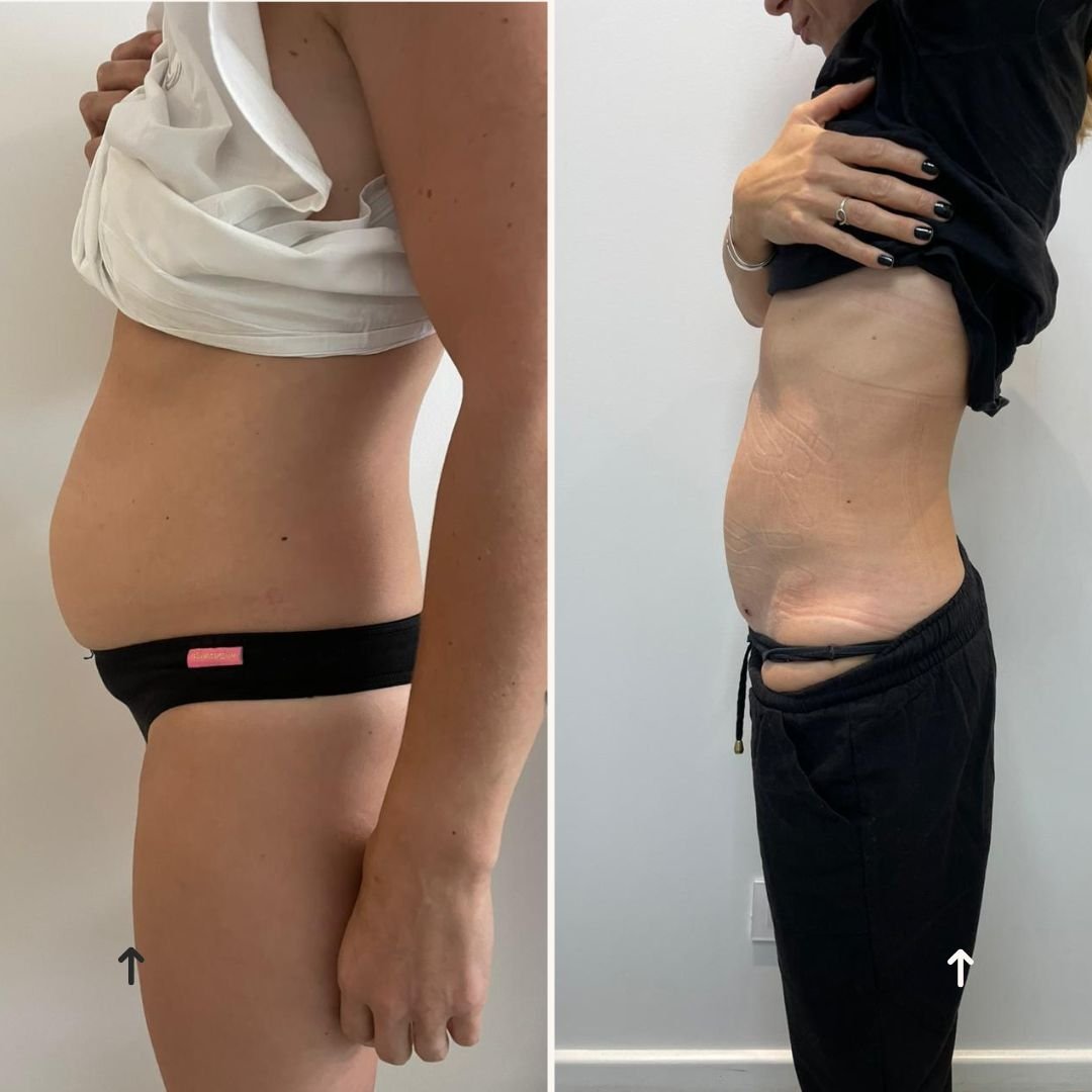 antes y despues dia...6