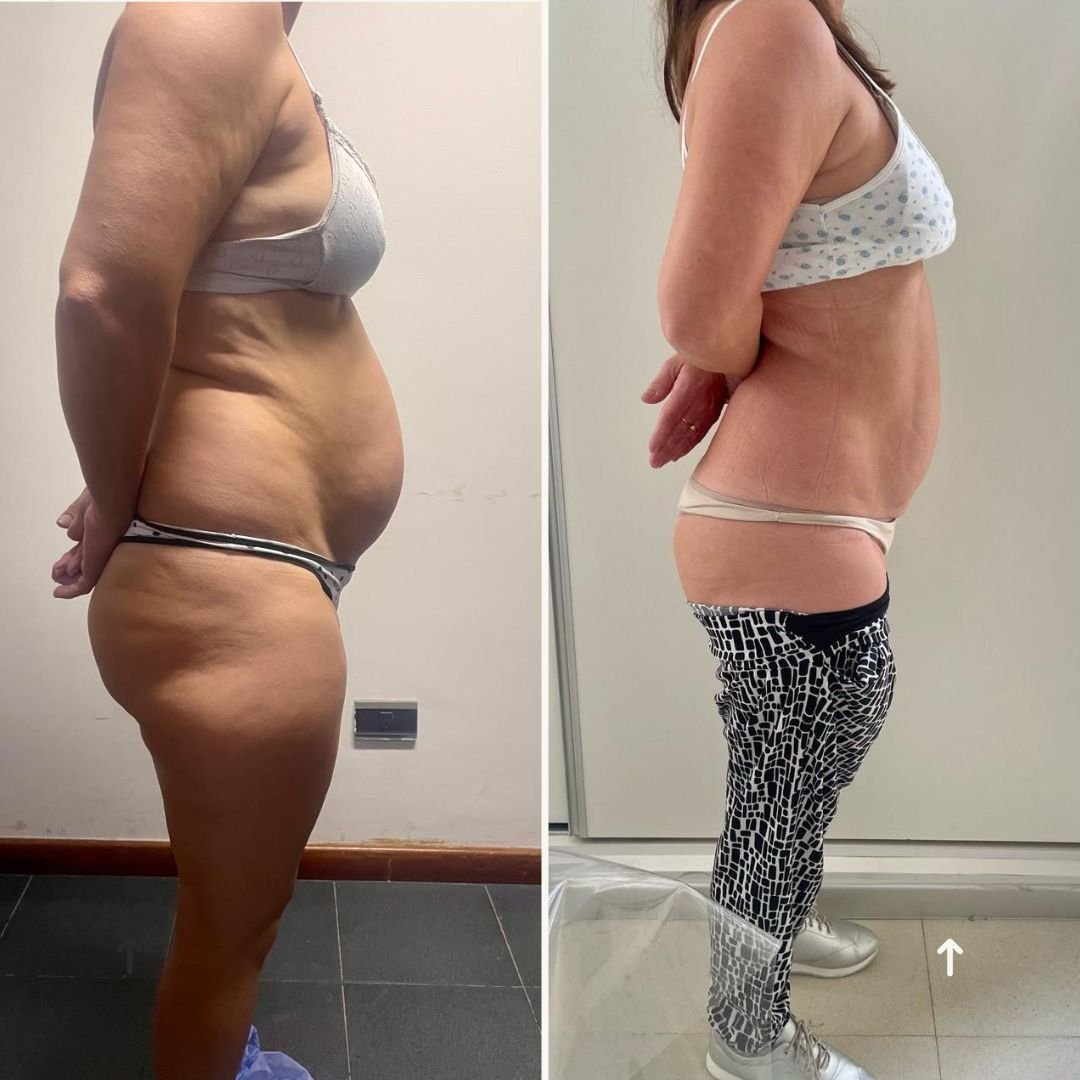 antes y despues dia...7